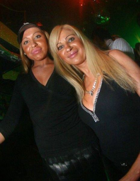 More-plastic-surgery-disasters14
