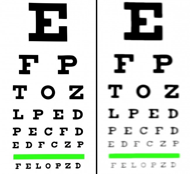benefícios abacaxi visão